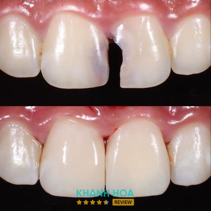 Nha Khoa Diên Phước – hình ảnh 2