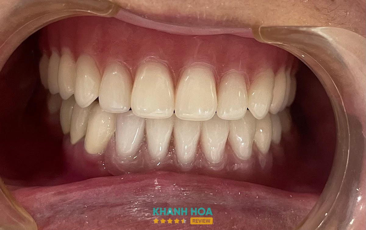 Nha Khoa Thẫm Mỹ Châu Gia – hình ảnh 2