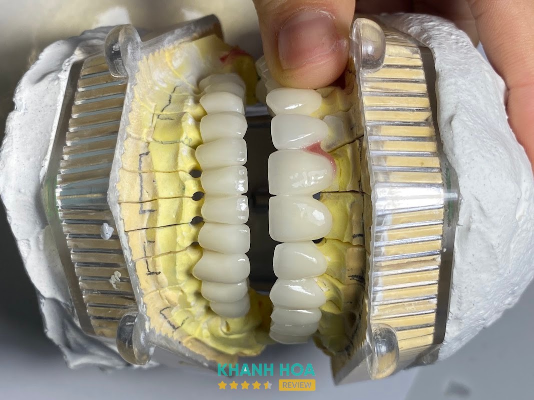 Nha Khoa Cam Lâm tại Dầu Sơn