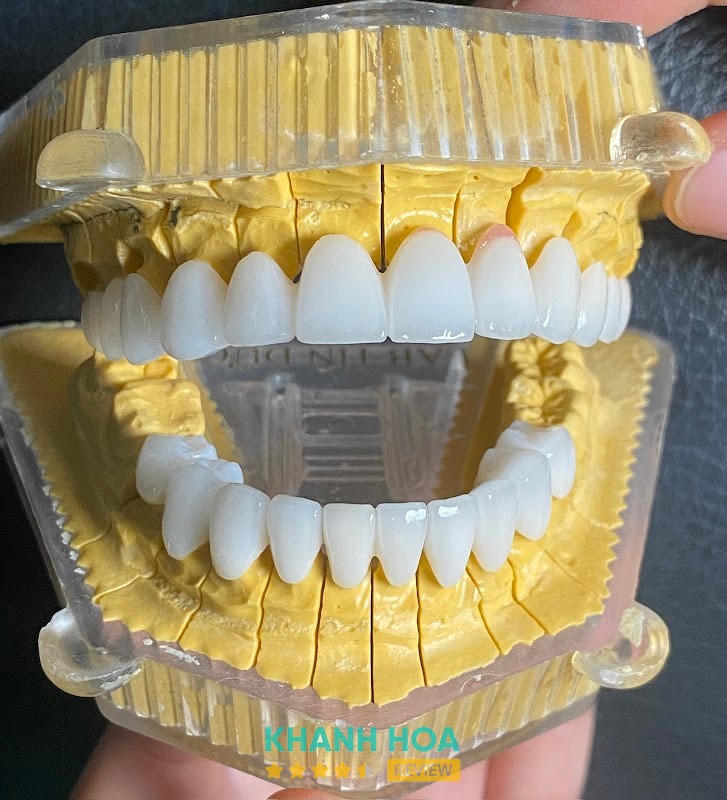 Dịch vụ tại Nha Khoa Cam Lâm