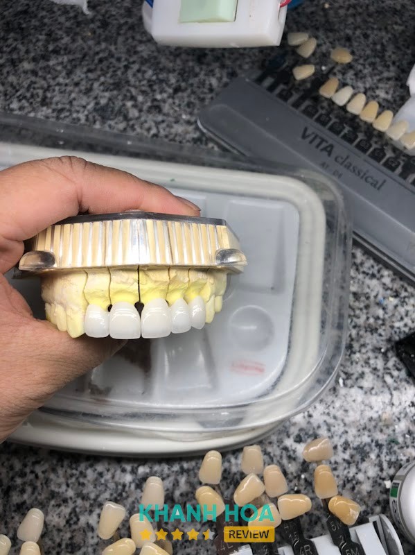 Khu vực phục hình tại Nha Khoa Cam Lâm