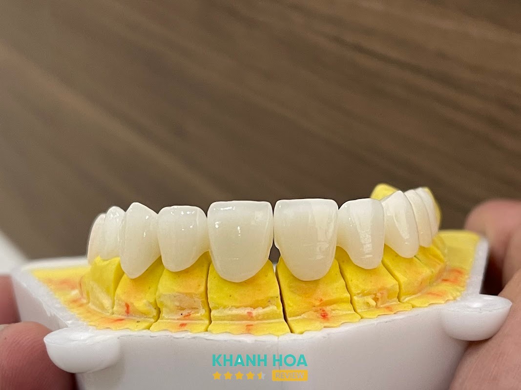 Khu vực điều trị tại Nha Khoa Mỹ