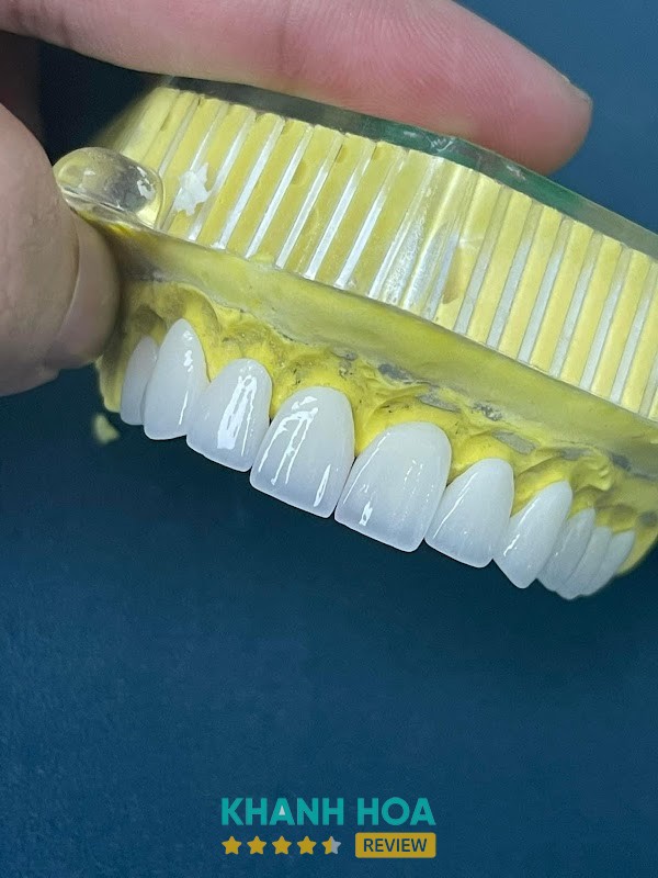 Dịch vụ nha khoa tại NHA KHOA HOÀN MỸ NINH HÒA