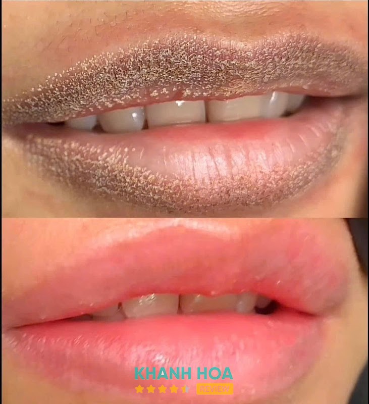 Minh Anh Spa - Ninh Hòa – hình ảnh 3