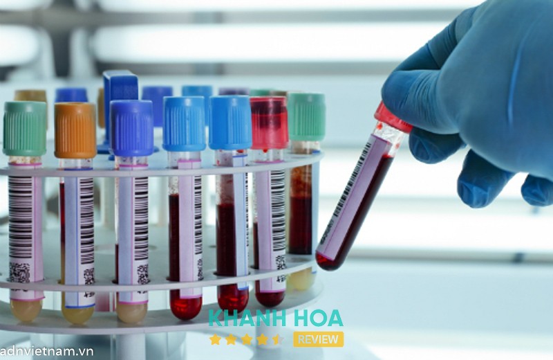 Xét Nghiệm ADN Nha Trang Gentis hình ảnh 3